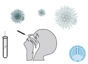 Recomendações gerais para a coleta de amostras respiratórias na presença de suspeita de COVID-19
